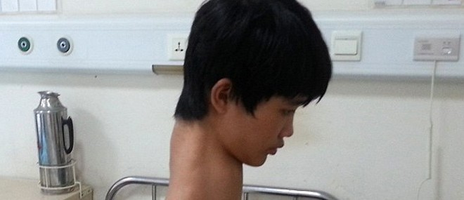 Un garçon de 15 ans avec le plus long cou en Chine